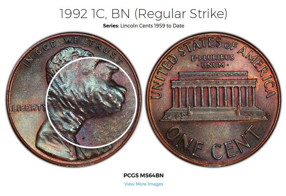 1992-D.-Anyone-Know-Whats-Going-On-With-The-Chin-/-Jaw-Area?