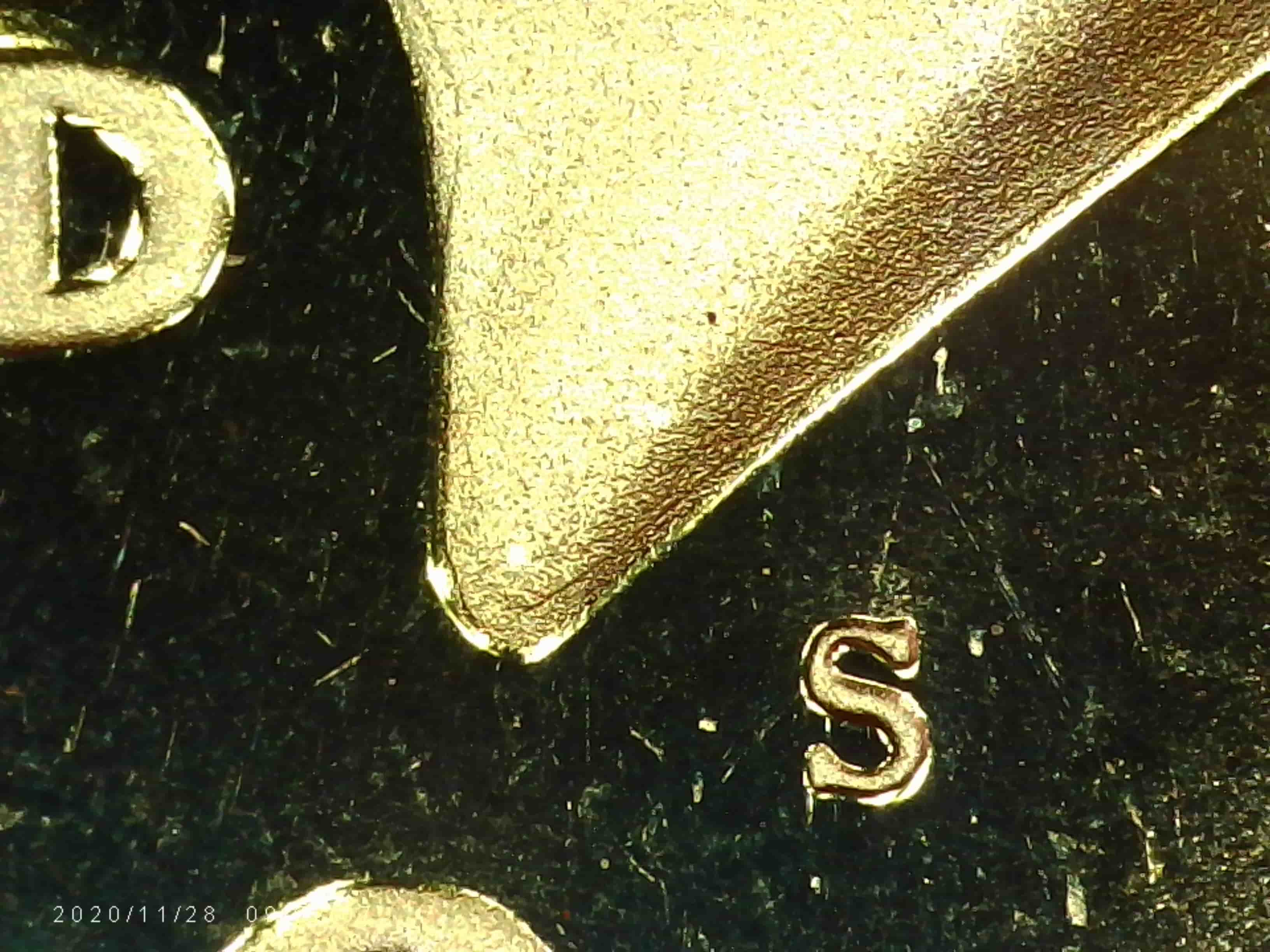 1985-S-Kennedy---MD-On-JFK's-Neck?