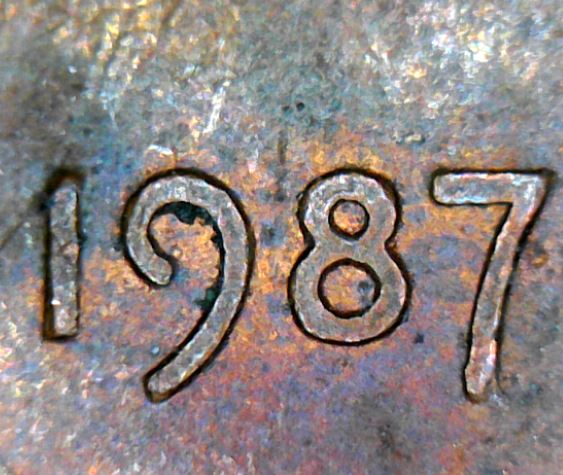 1987-P-LMC---Is-This-Eye-Normal?