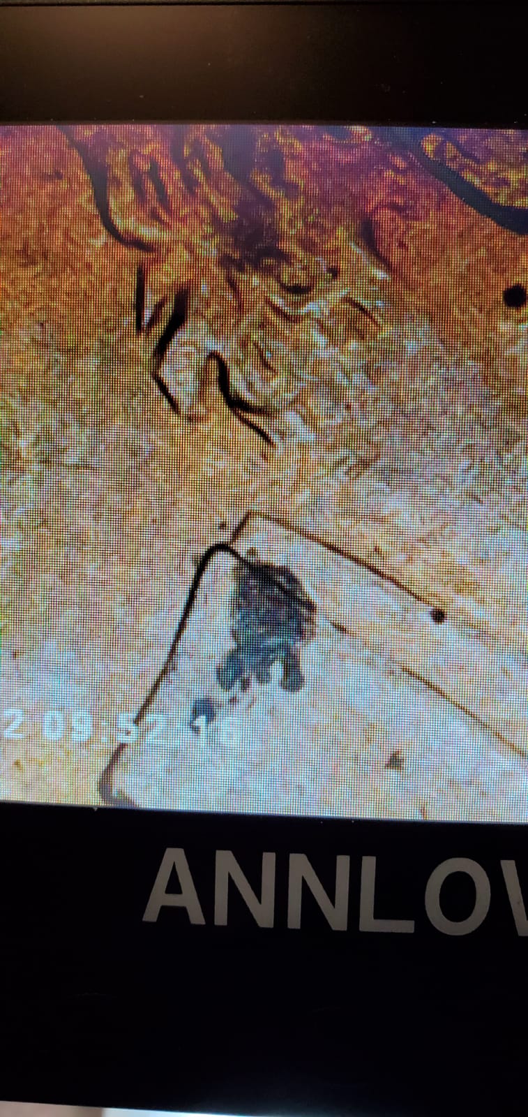 Hair-Error-On-1998-Lincoln-Penny