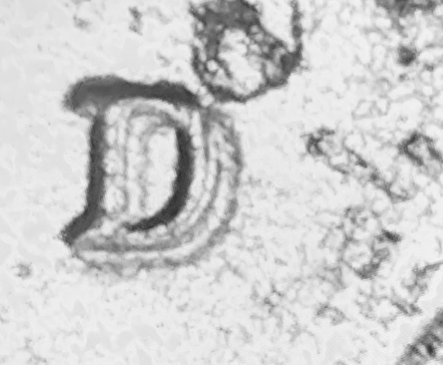 Doubled-Die?-Pls-Help!-DDO-&-DDR--2019-D-Lincoln-Shield-Cent