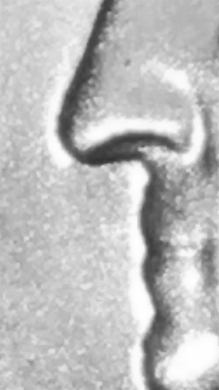 Possible-1965-25c-DDO-FS-101-26-Grade?