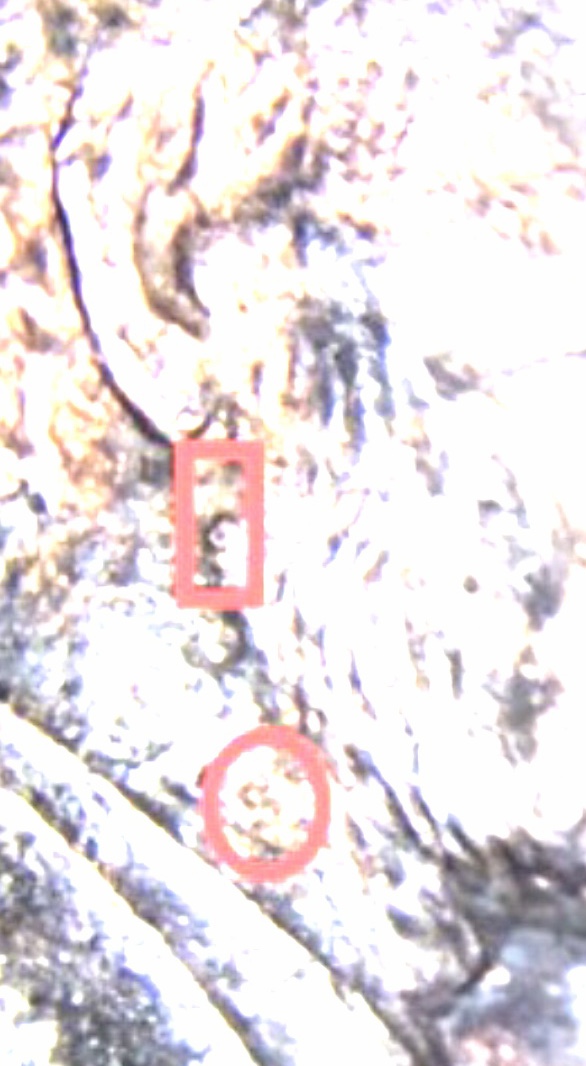 Cents-Like-This-Isn't-Common---1992-D-Lincoln-Cent---Pictures-And-Assumptions-And-Explanations