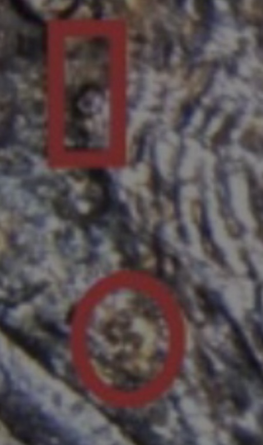 Cents-Like-This-Isn't-Common---1992-D-Lincoln-Cent---Pictures-And-Assumptions-And-Explanations