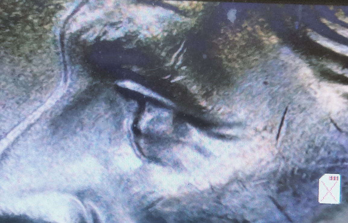 2023-P-Doubled-Eye-Roosevelt-Dime?