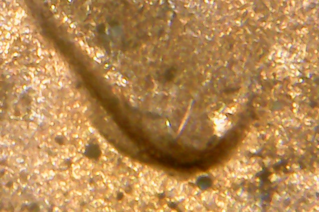2015-D-LSC-DDO-002-Double-Earlobe