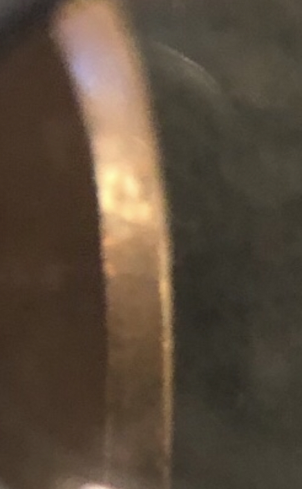 1944-D-Lincoln-With-A-Blank-Reverse!-Any-Value?