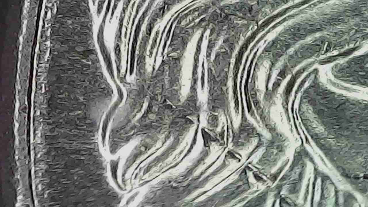 Hello,-New-To-All-Of-This-But.-I-Found-A-2020-P-Nickel-With-An-Obvious-Die-Error
