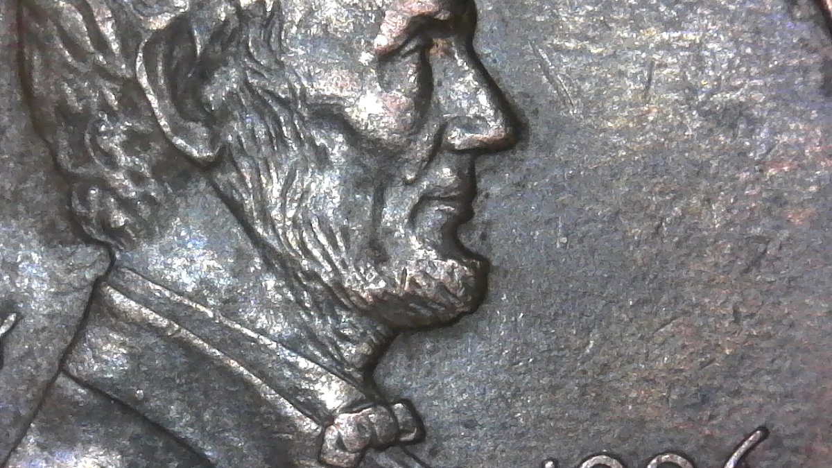 Who-Knew-That-Lincoln-Had-A-Mole