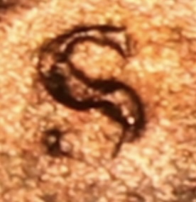 Buy-The-Coin,-Not-The-Slab:-A-Gallery-Of-Grading-Gaffes!