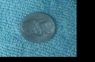 1984-P-Nickel-Planchet-Wrong-Material?