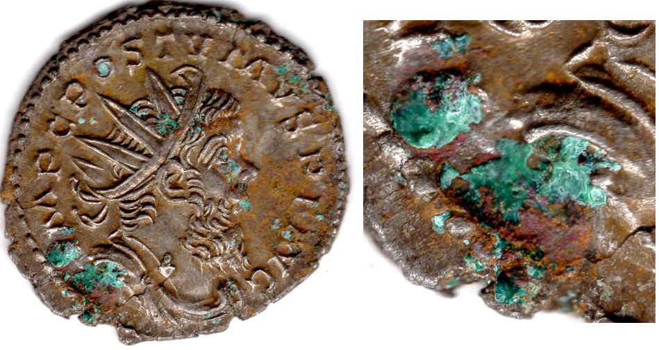 Removing-Verdigris-From-A-Postumus-Antoninianus