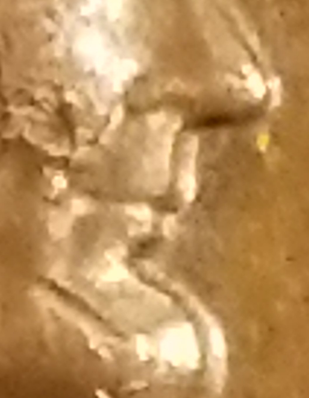 1964-D-&-S-Dmm-Lincoln-Penny-Errors-Hot-Lips-Is-This-Real?