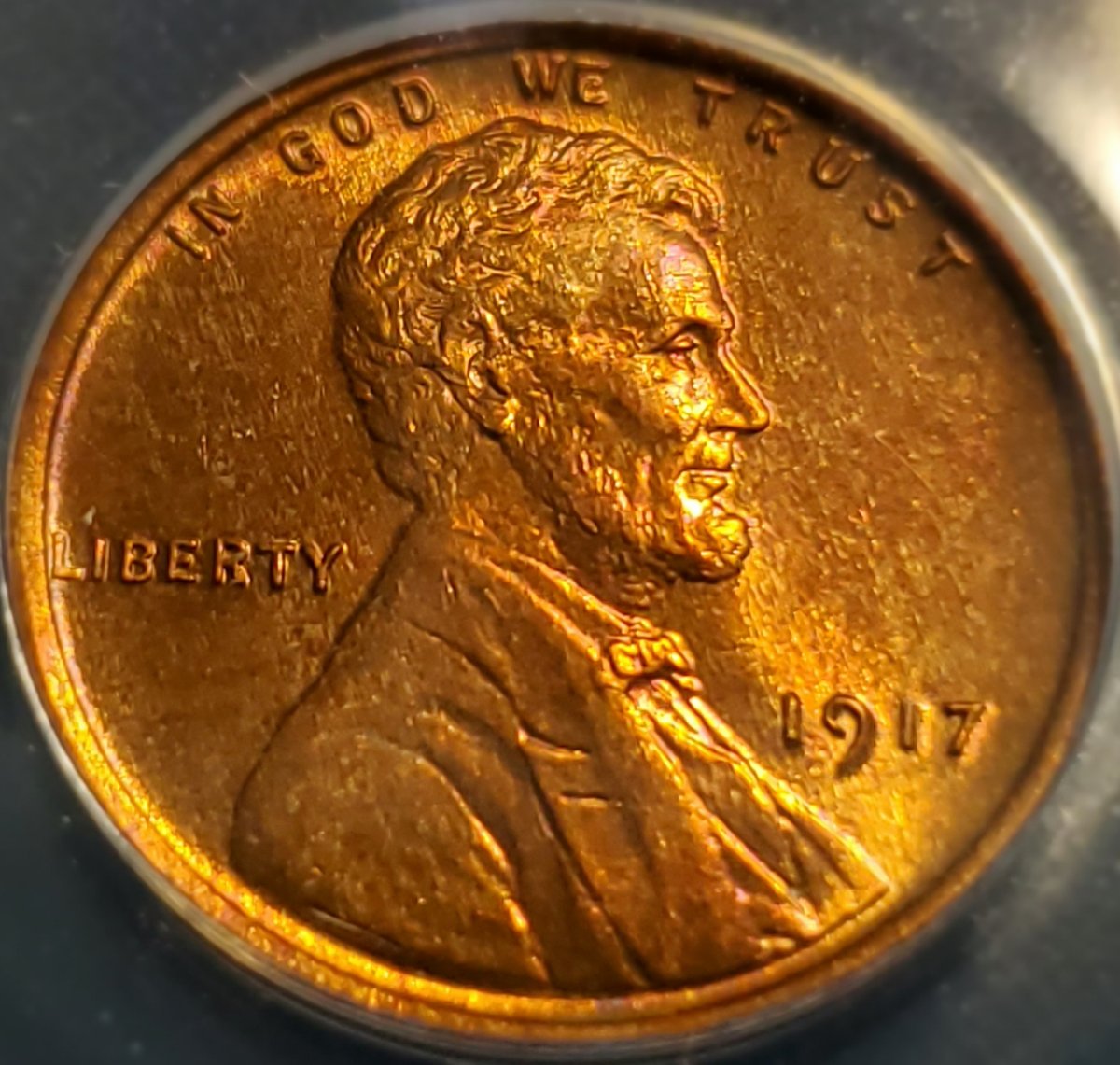 1917-1c-You-Vs.-ANACS