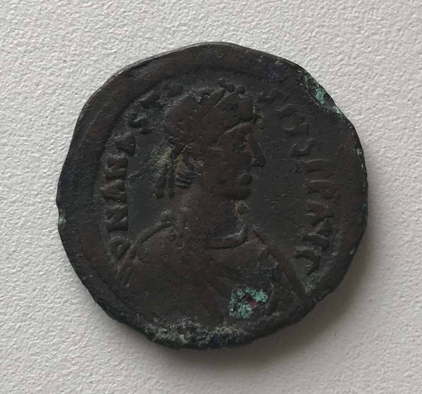 A-Very-Sharp-Anastasius-But-The-Bronze-Disease...