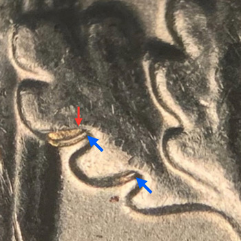 2019-D-Roosevelt-Dime.-Maybe-Not-DDR.