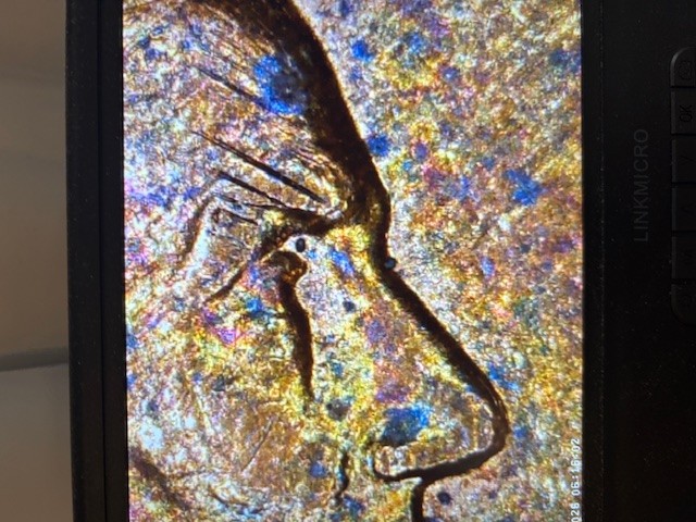 1991-Penny--What-Can-Cause-This?