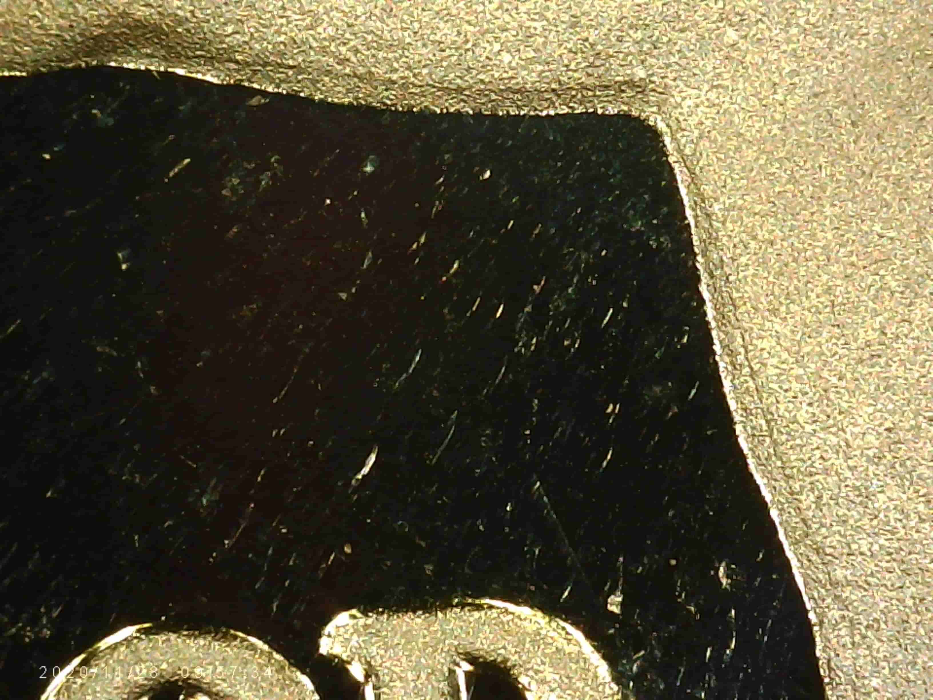 1985-S-Kennedy---MD-On-JFK's-Neck?