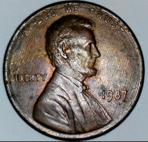 1987-P-LMC---Is-This-Eye-Normal?