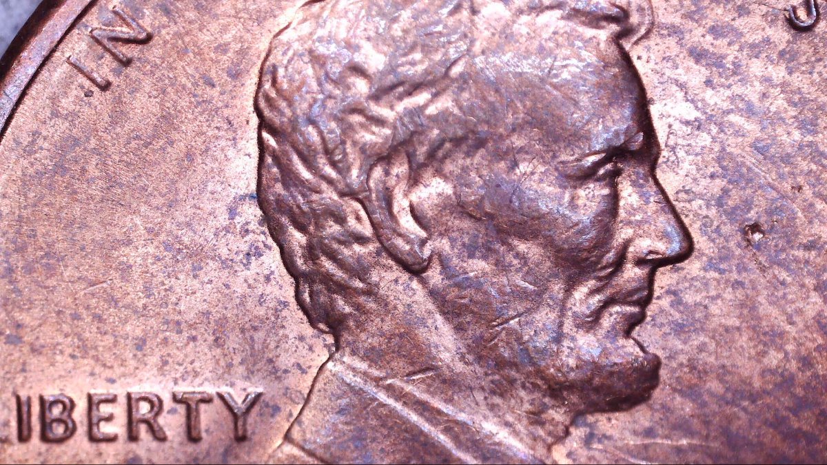 1986-P-LMC-Ear-Lobe-Abnormality,-Take-A-Look