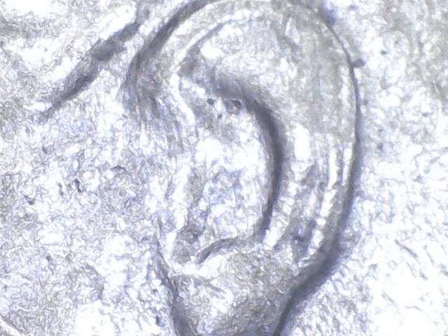 1983-P-Roosevelt-Dime.--Possible-Doubling-Both-Sides?
