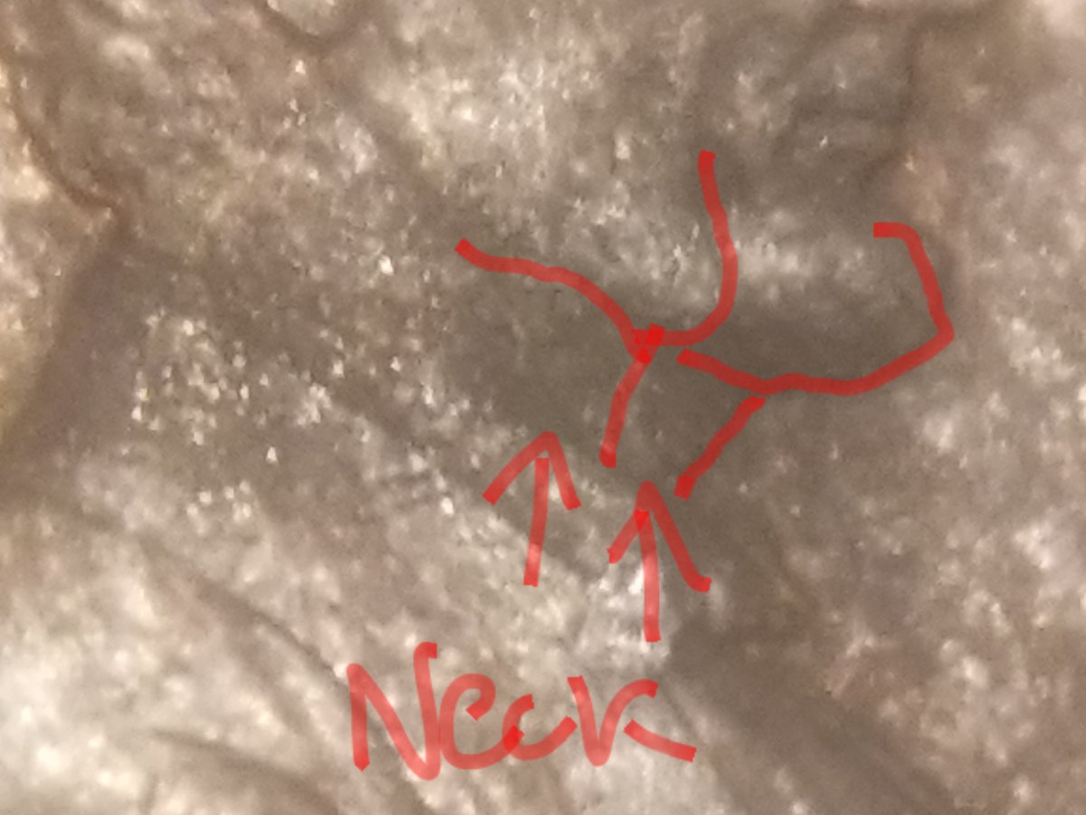1988-D-Lincoln-Penny-Double-Face?