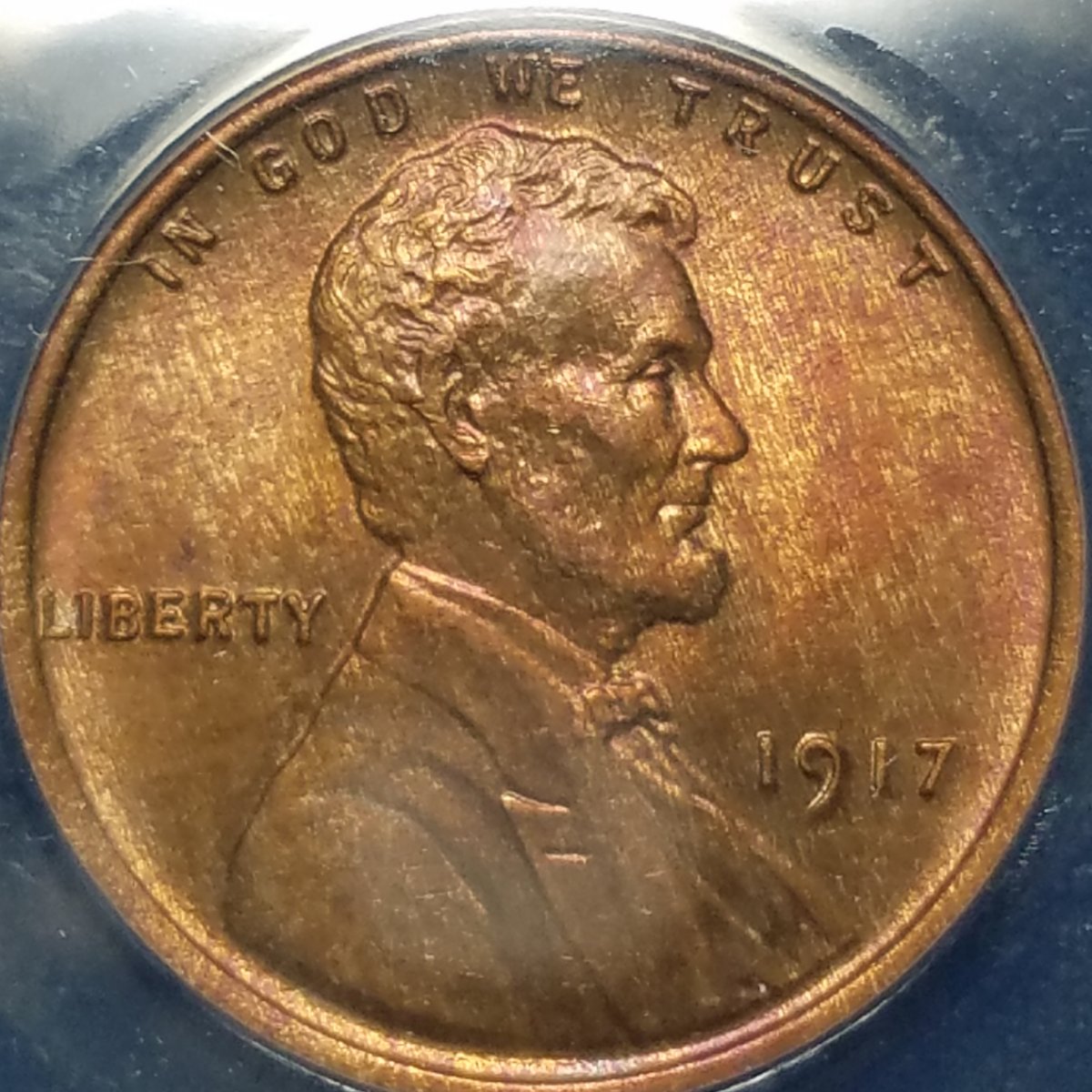 1917-1c-You-Vs.-ANACS