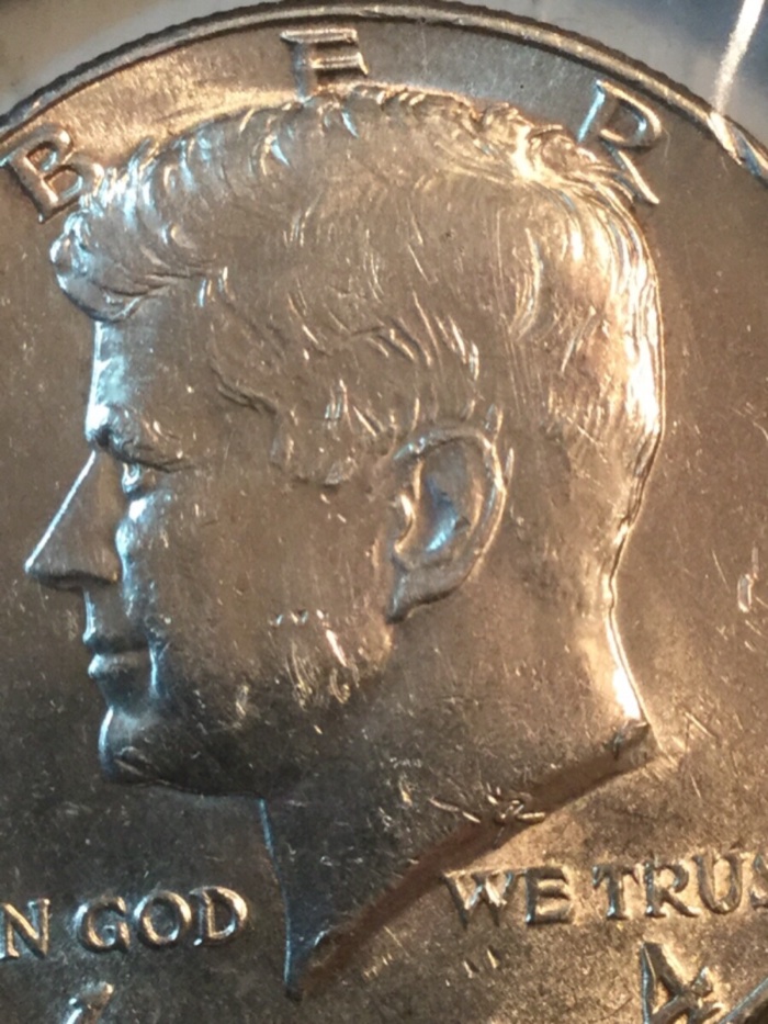 Please-Grade;-Could-This-Be-Heavy-Hair?