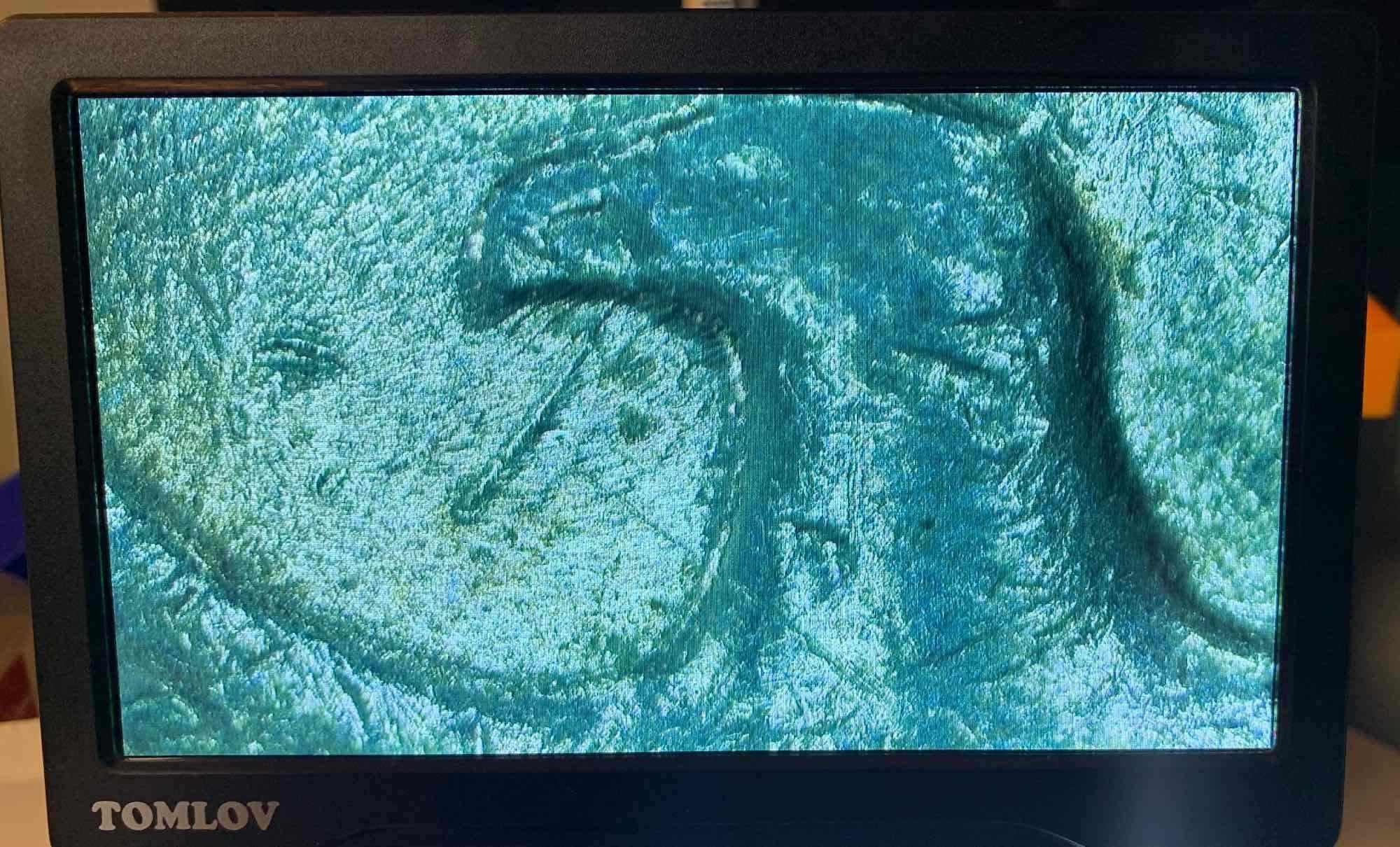 Spitting-Eagle?-Or-Nah?-1983-P-Quarter
