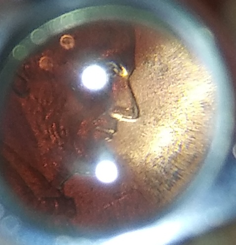 2005-D-Lincoln-Penny-With-Double-Nose