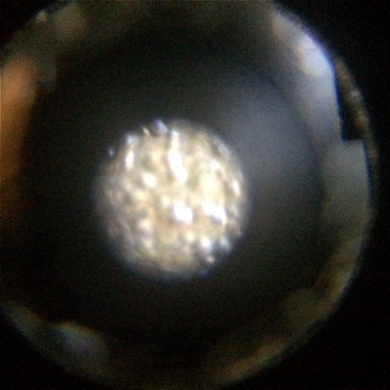 Strange-Metal-Bumps-On-A-1991-D-Lincoln-Cent.
