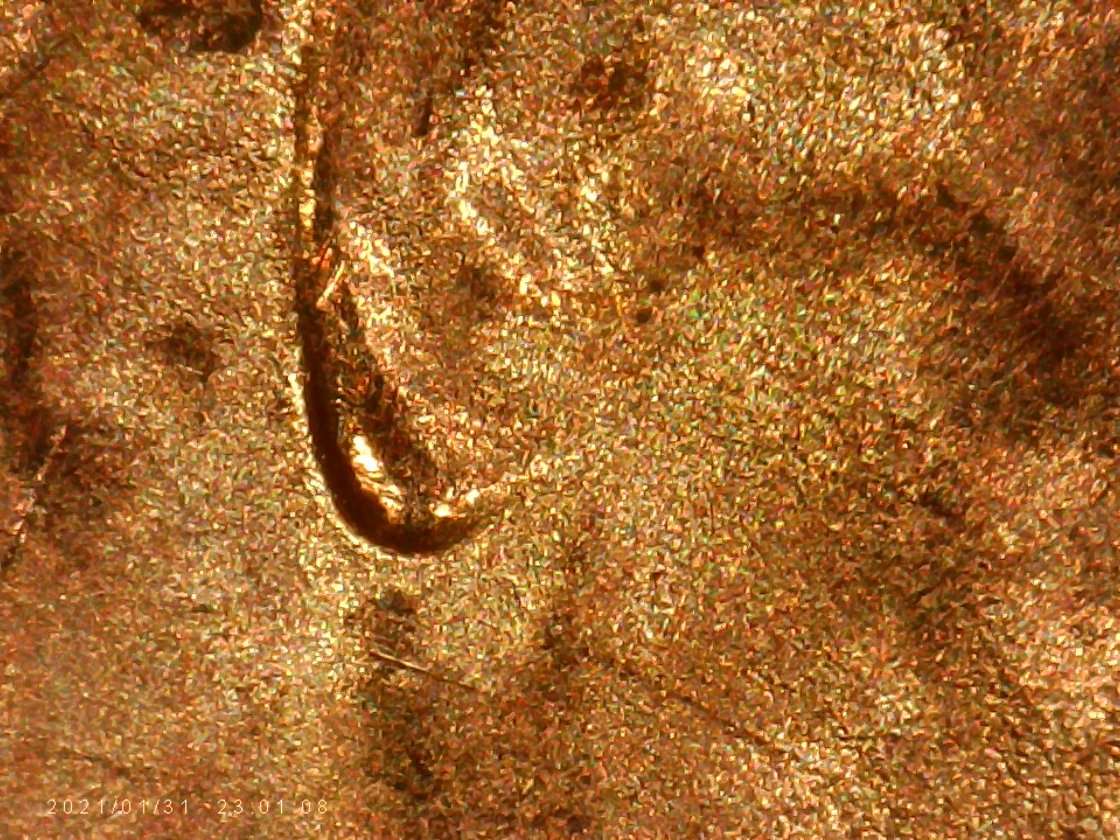 2020--LSC.earlobe-Doubling-Is-That-Normal-For--.2020-?