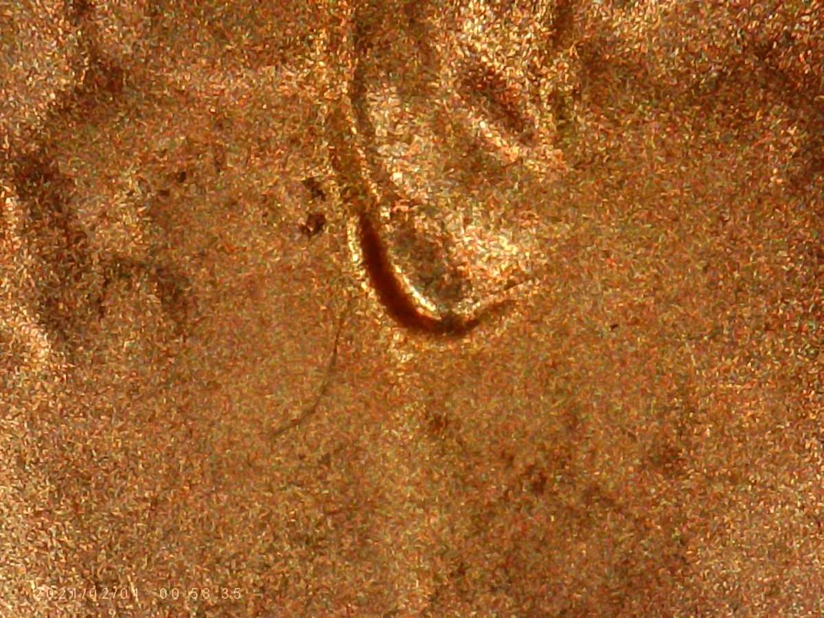 2///-2021-LSC.-Earlobe-And-Die-Chips.are-They-Norm,?