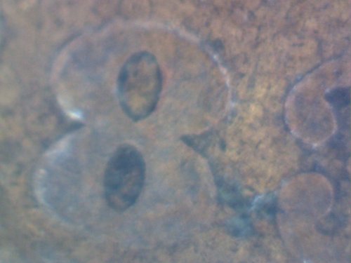 1883-Indian-Head-Struck-Through-Grease-And?
