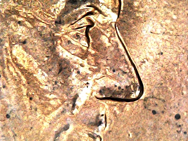 2000-D-LMC,-Thickness-Under-Eye