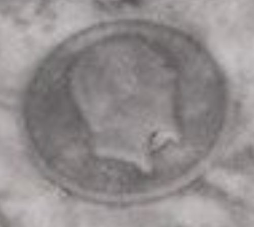 Help!-What-Coin-Is-This-Woman-Wearing?-Senegal,-1910
