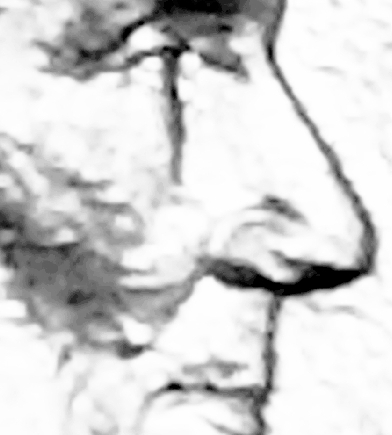 1993-D-Lincoln-Penny-Double-Eye?