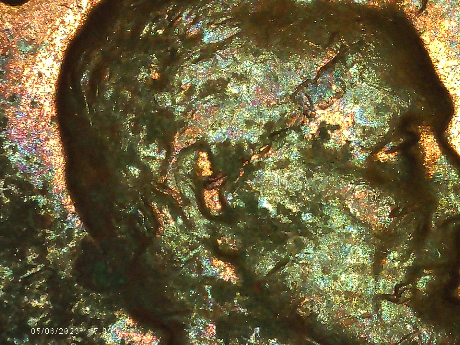 1962-LMC-What-Is-Going-On-With-The-Obverse-Is-This-PMD-Or-Something-Else