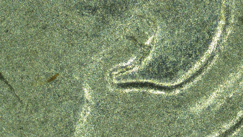 1994-D-Dime-Possible-Doubling-Inside-Of-Ear-And-Something-On-Neck