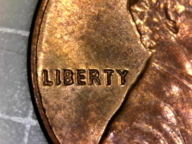 1979-BU-Philadelphia-LMC-Worst-Case-Of-MD-I've-Ever-Seen