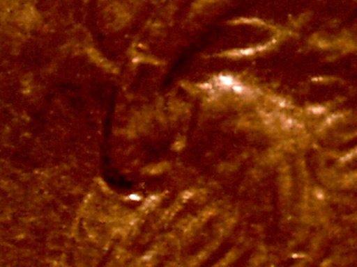 1993-LMC-Help/Quick-Opinions-On-Identifying-Raised-Shape-Under-Ear