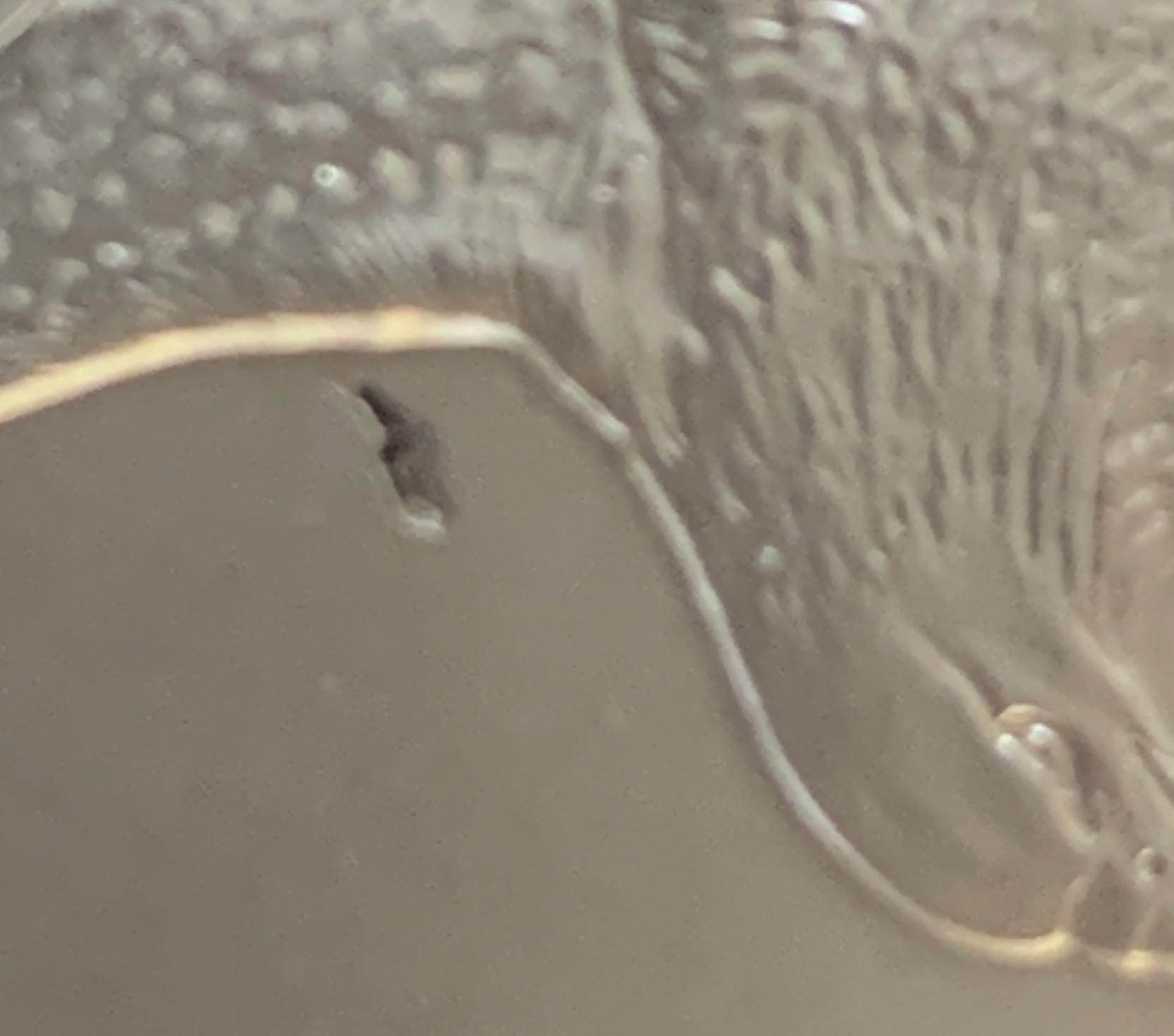 2022-Silver-American-Eagle-Mint-Error?