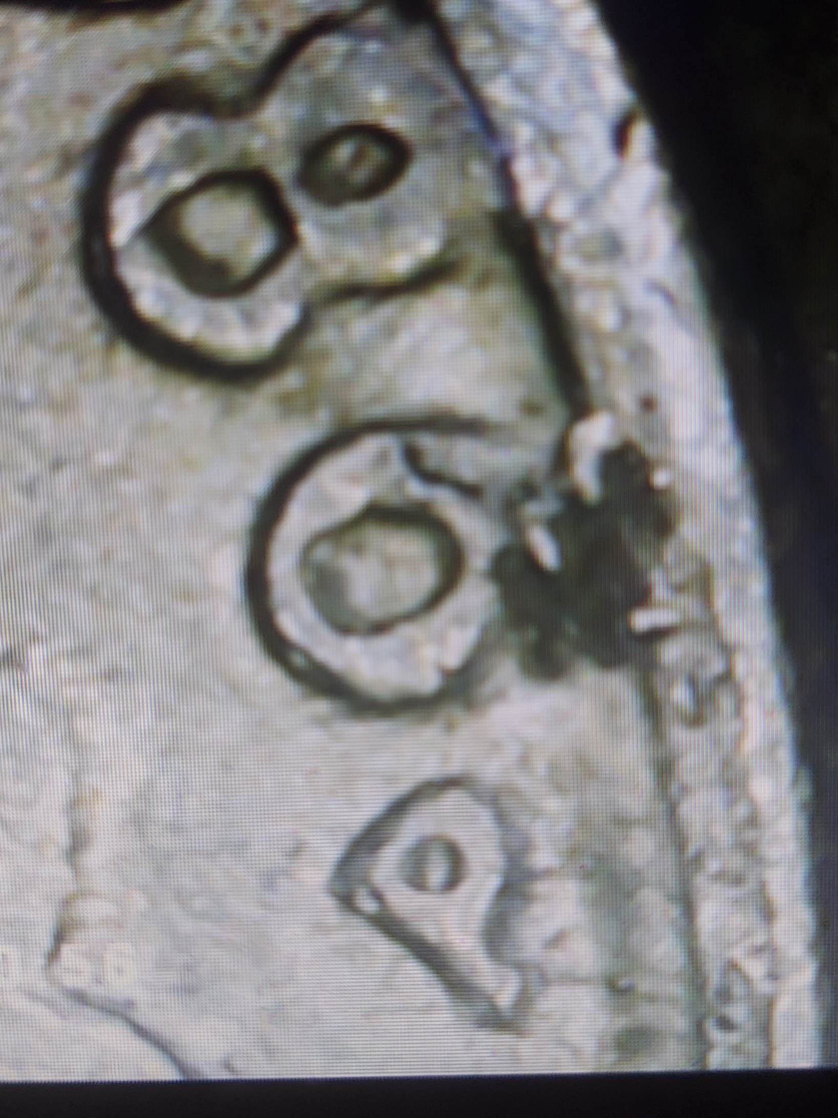 1986-P-DDO-/-DDR-And-Rim-Error?