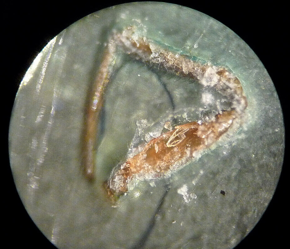 Was-An-Insect-Squished-Inside-This-Dime-When-Is-Was-Struck?-1984-P