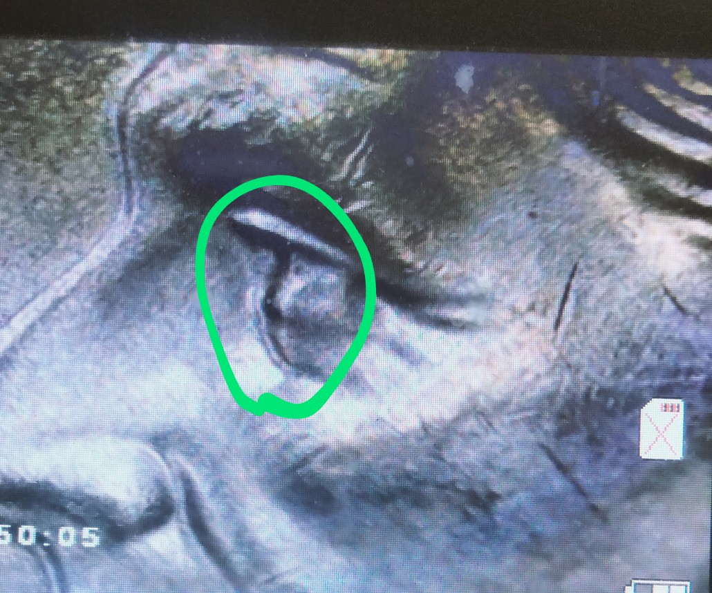 2023-P-Doubled-Eye-Roosevelt-Dime?