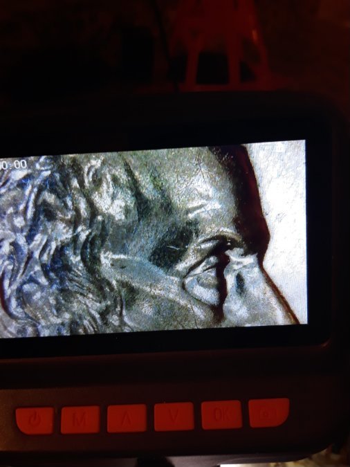 2001-D-LMC-Doubled-Eyelid-Or-Split-Plate-Bubbling?