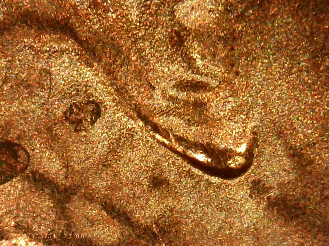 2020--LSC.earlobe-Doubling-Is-That-Normal-For--.2020-?