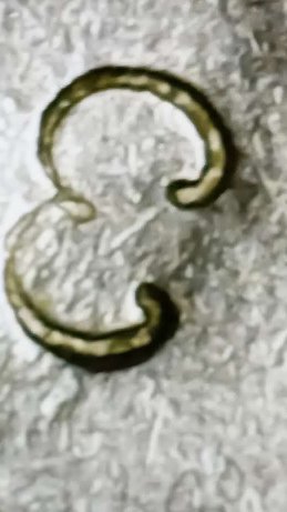 Can-Someone-Tell-Me-What-This-Is-On-1971-D-Rosevelt-Dime?
