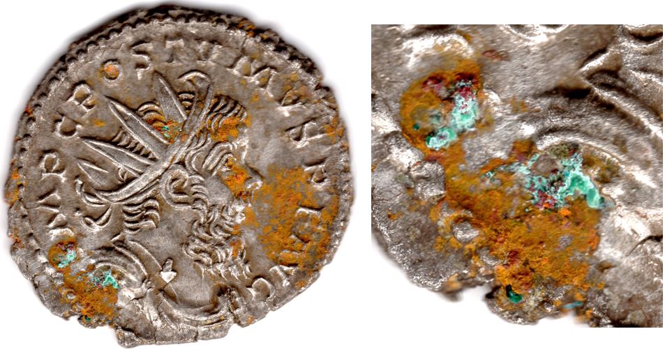 Removing-Verdigris-From-A-Postumus-Antoninianus