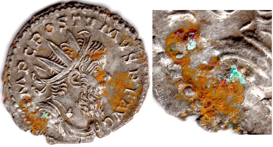 Removing-Verdigris-From-A-Postumus-Antoninianus